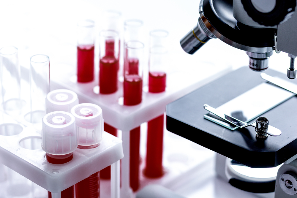 Morfologia krwi to jedno z podstawowych badań (fot. Shutterstock).