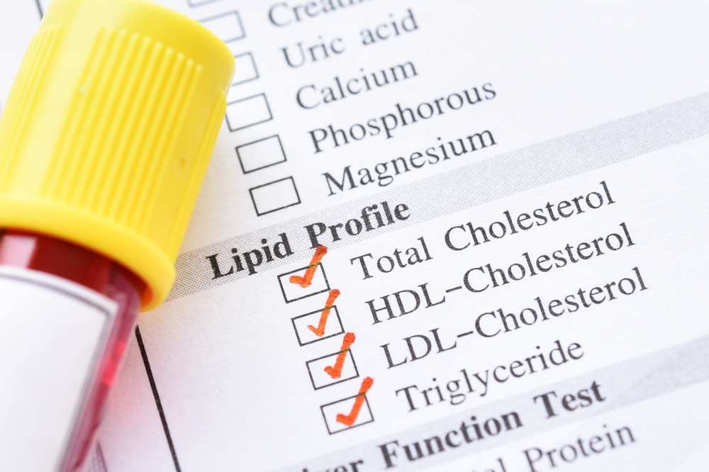 Lipidogram to ilościowa ocena frakcji dla cholesterolu oraz trójglicerydów. Jest on przydatny w ocenie ryzyka rozwoju chorób sercowo-naczyniowych, miażdżycy oraz dyslipidemii.  (fot. Shutterstock).