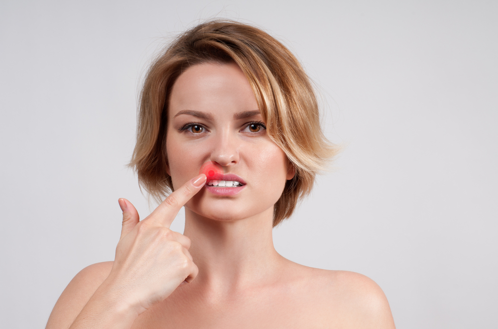 Opryszczka jamy ustnej i skóry okołowargowej jest najczęściej występującą postacią kliniczną zakażenia HSV (fot. Shutterstock).